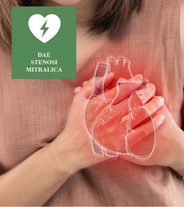 LA STENOSI MITRALICA